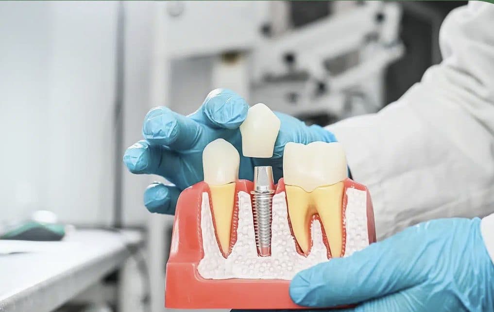 Newlife Dental Clinic case study: New site and local campaign launched on one coordinated timeline.